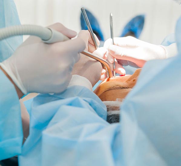 IV Sedation Oral Surgery | Birmingham, AL | WISE Oral - sedation(1)